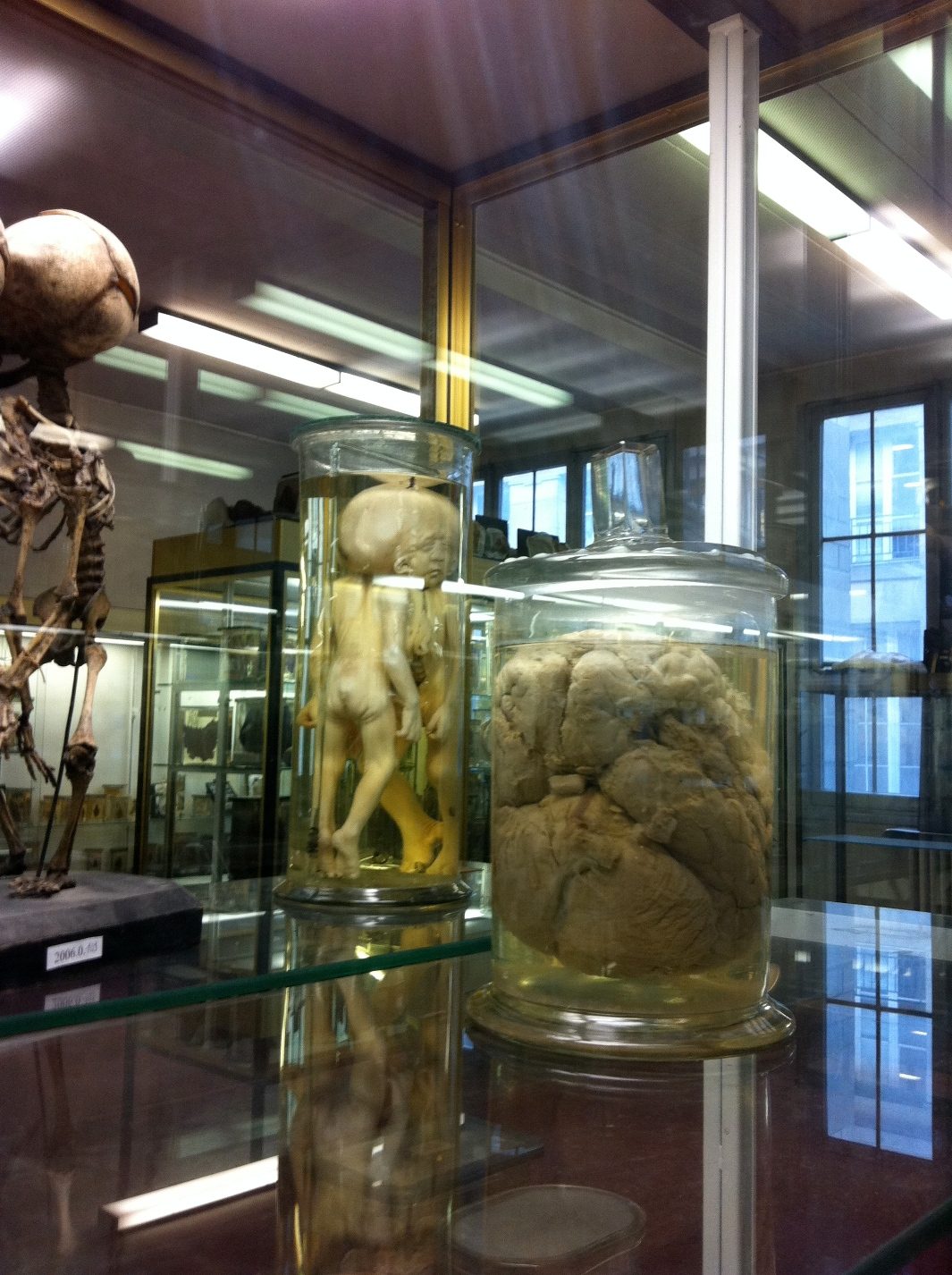 Monsieur Tan's brain, Musee Dupuytren, Paris by Rosa Longo (1).jpg